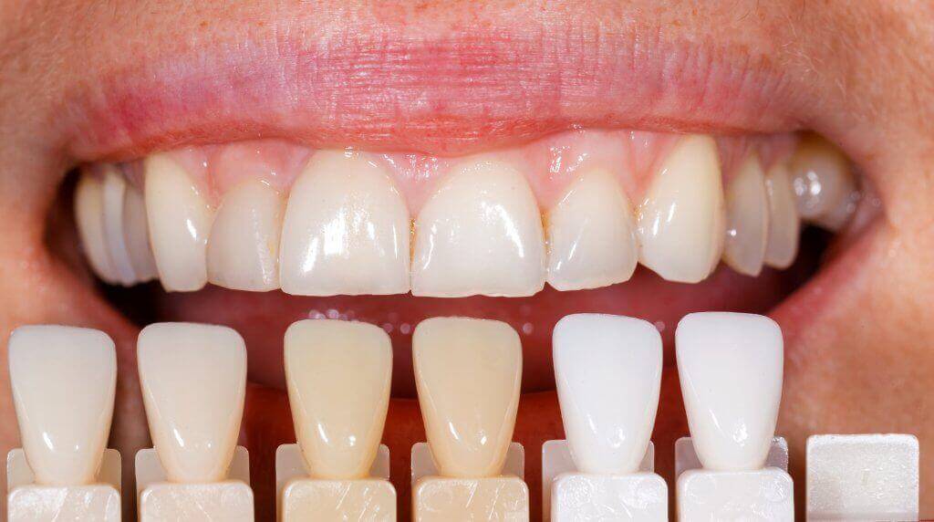 стоматология шымкент, детская стоматологиястоматология шымкент круглосуточно, детская стоматология в шымкенте, стоматология