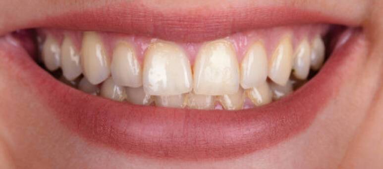 детская стоматология шымкент, ортопедическая стоматология