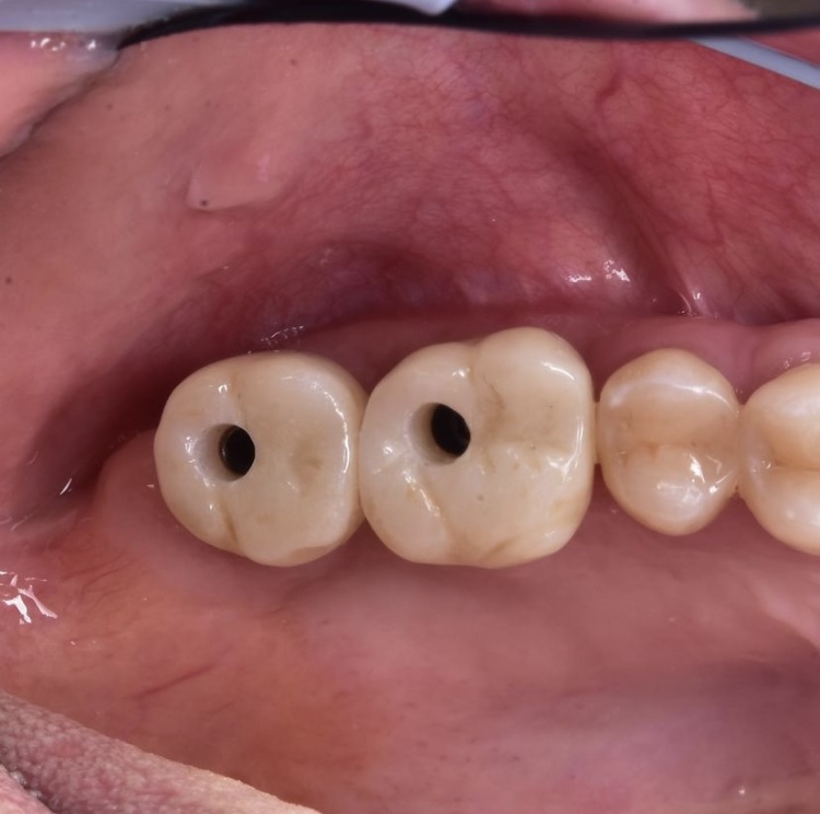 детская стоматология шымкент, ортопедическая стоматология